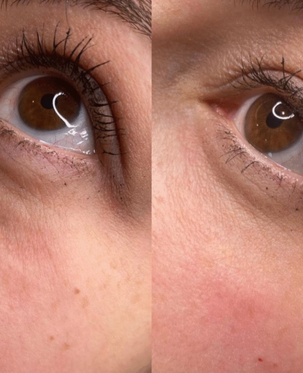 RELLENO DE OJERAS
