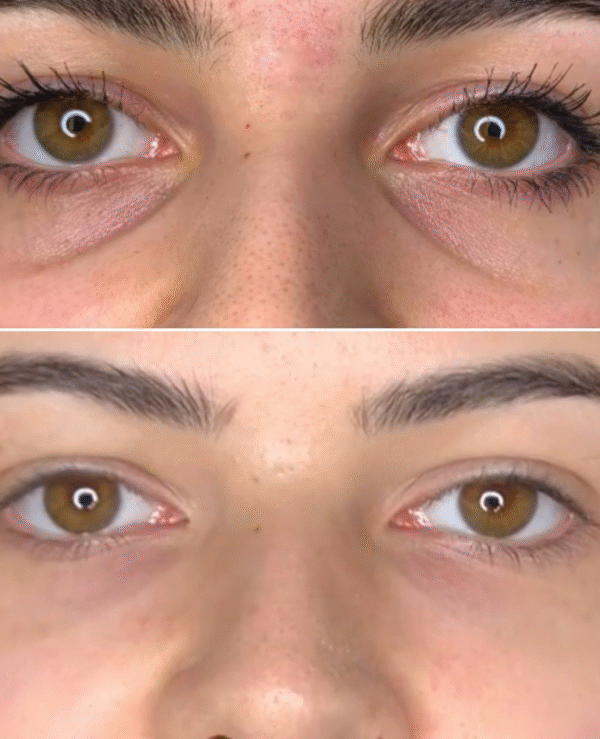 RELLENO DE OJERAS