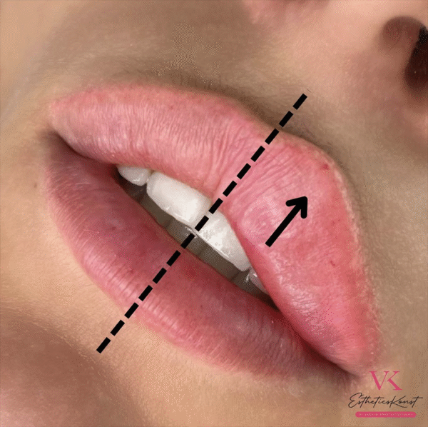 LABIOS RUSOS (RUSSIAN LIPS)