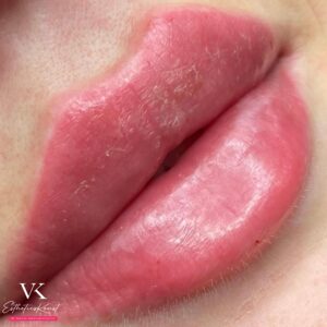 LABIOS RUSOS(RUSSIAN LIPS)