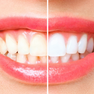 PACK 5 DENTAL