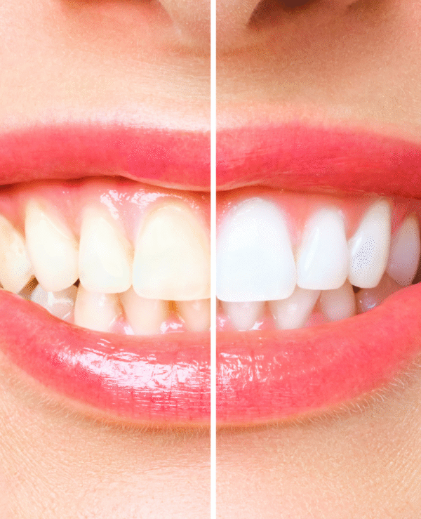 PACK 5 DENTAL